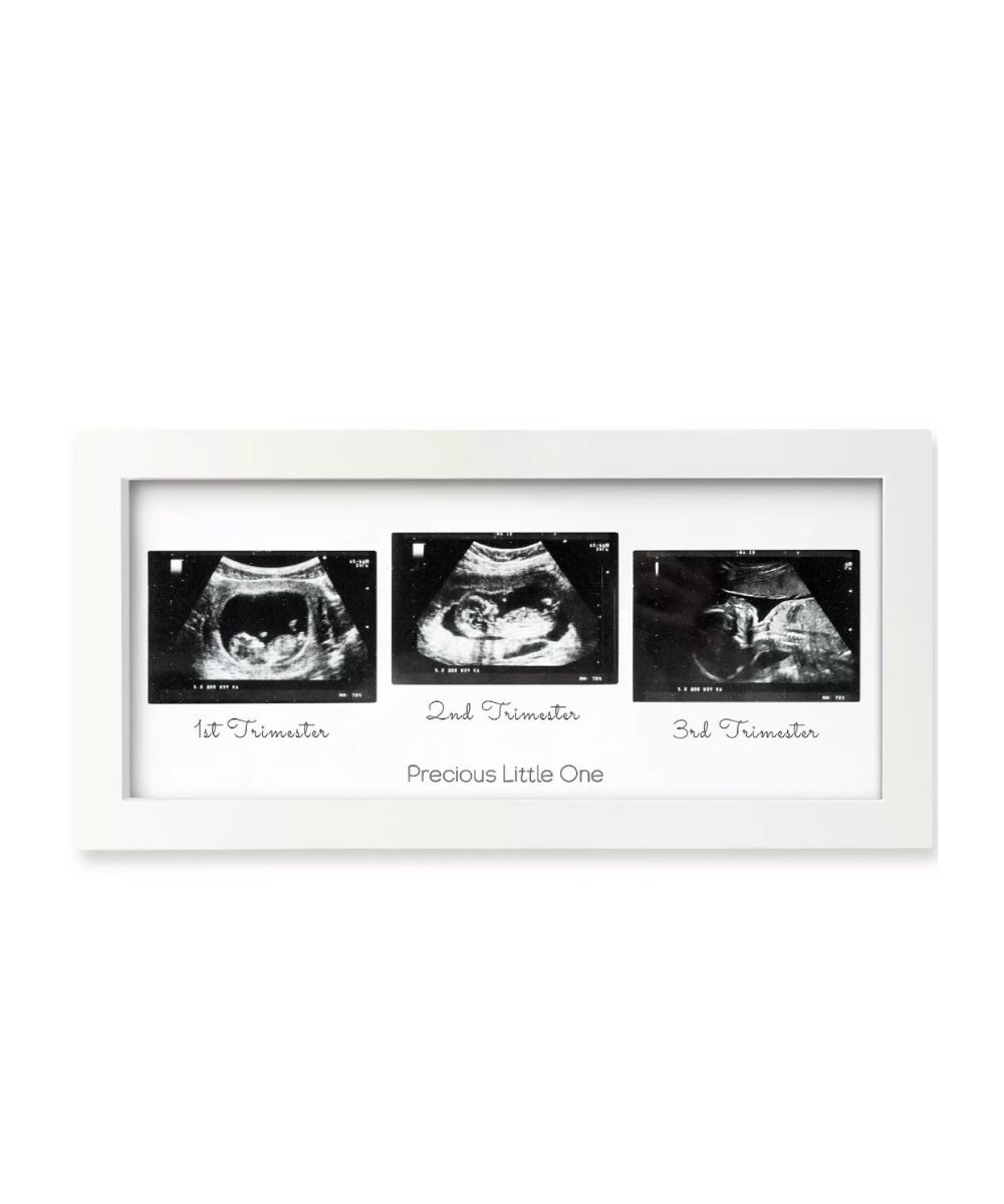 KEABABIES Cadre photo à ultrasons, blanc alpin